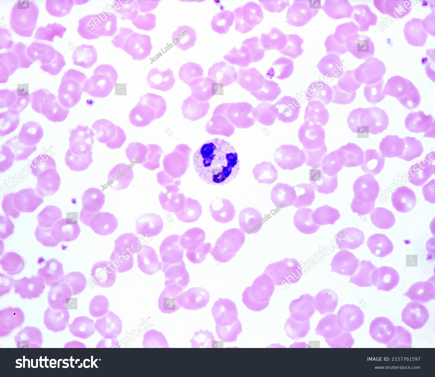 Human Blood Smear Showing Neutrophil Leukocyte Stock Photo 2157761597 ...