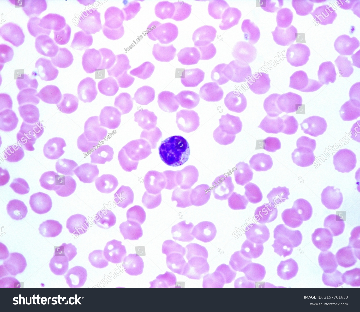 Human Blood Smear Showing Lymphocyte Granules Stock Photo 2157761633 ...