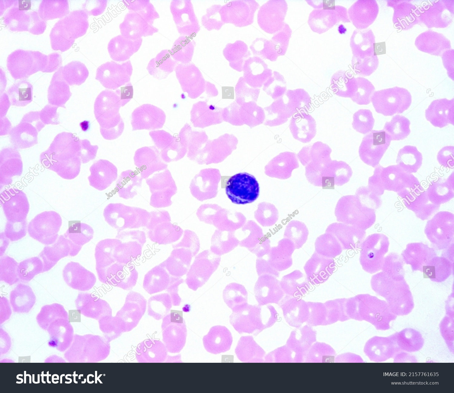 Human Blood Smear Showing Lymphocyte Small Stock Photo 2157761635 ...