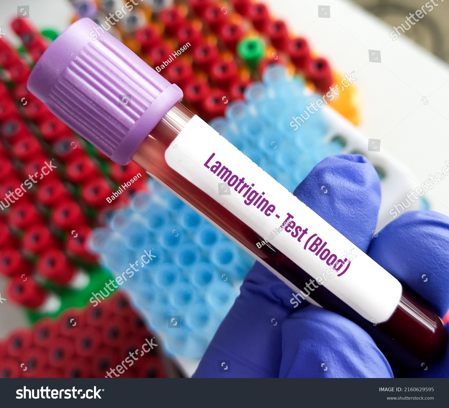 Blood Sample Lamotrigine Blood Test Monitoring Stock Photo 2160629595 ...