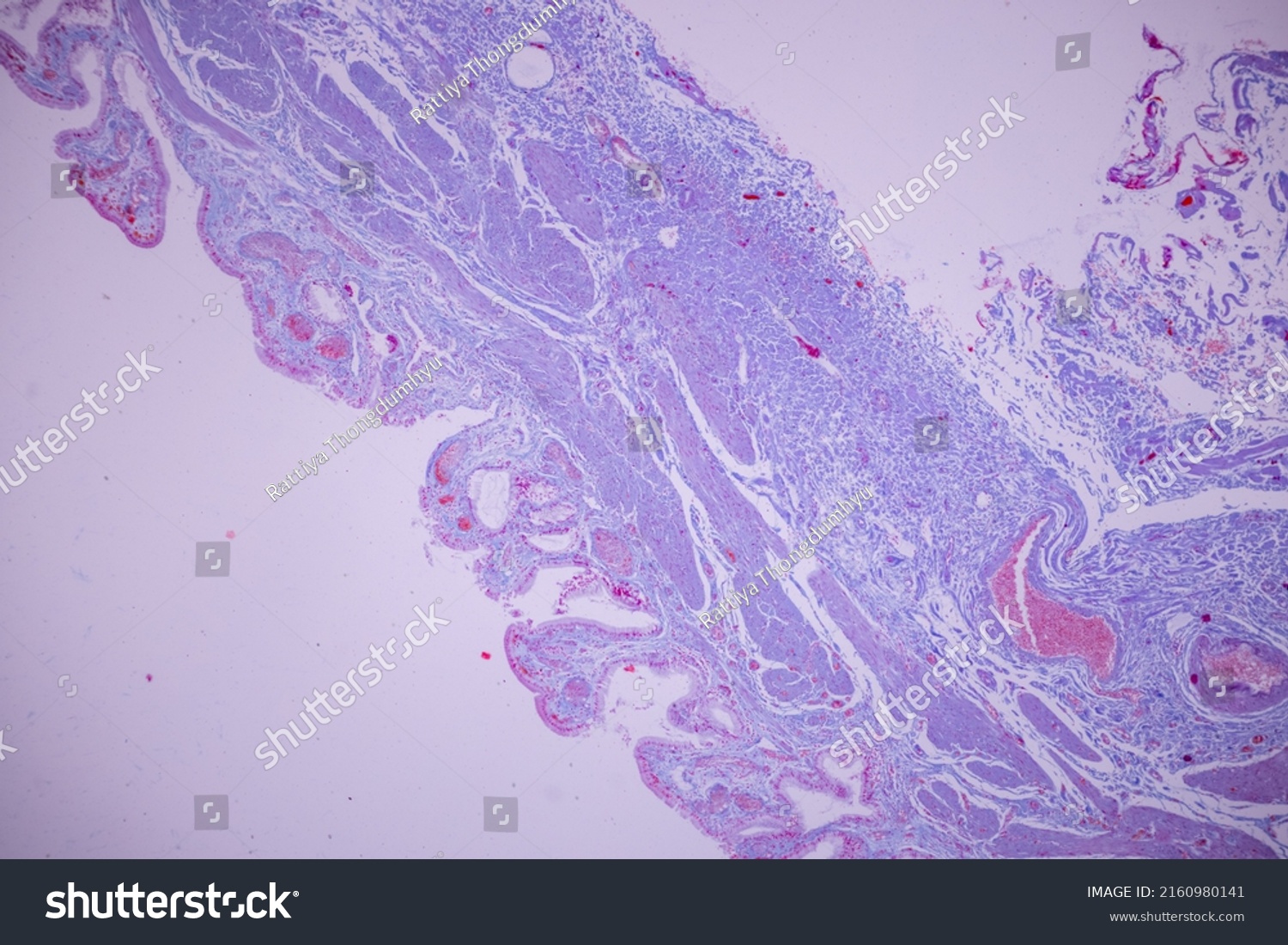 Columnar Epithelium Human Gall Bladder Under Stock Photo 2160980141 ...