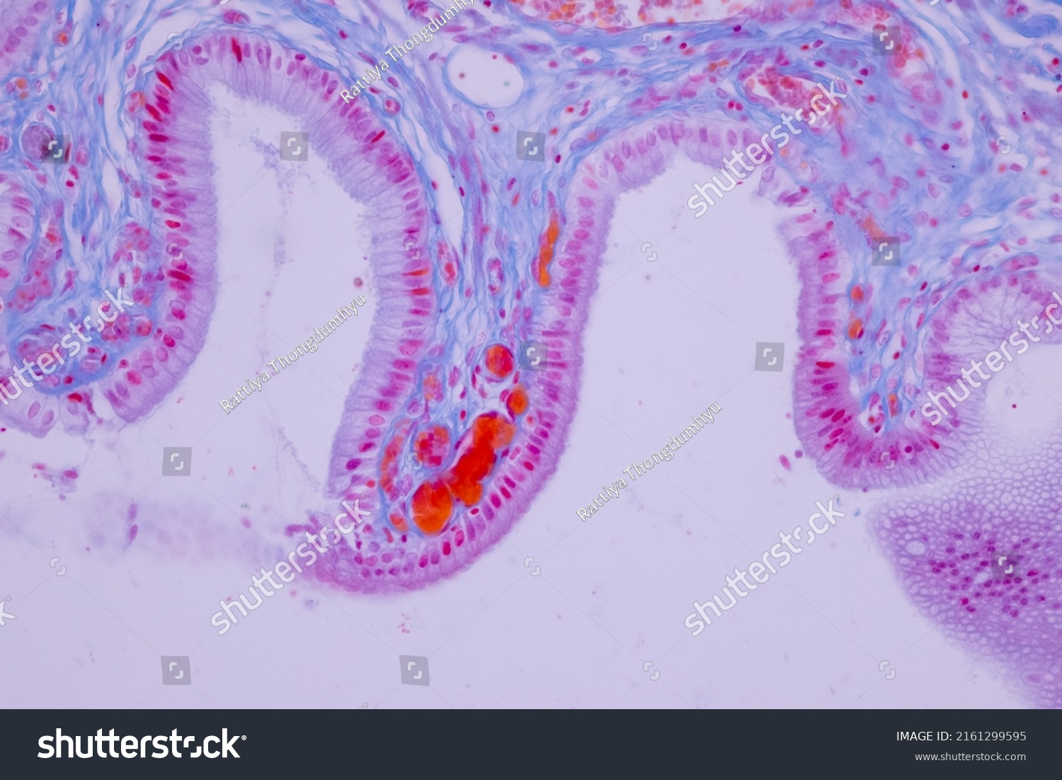 Columnar Epithelium Human Gall Bladder Under Stock Photo 2161299595 ...