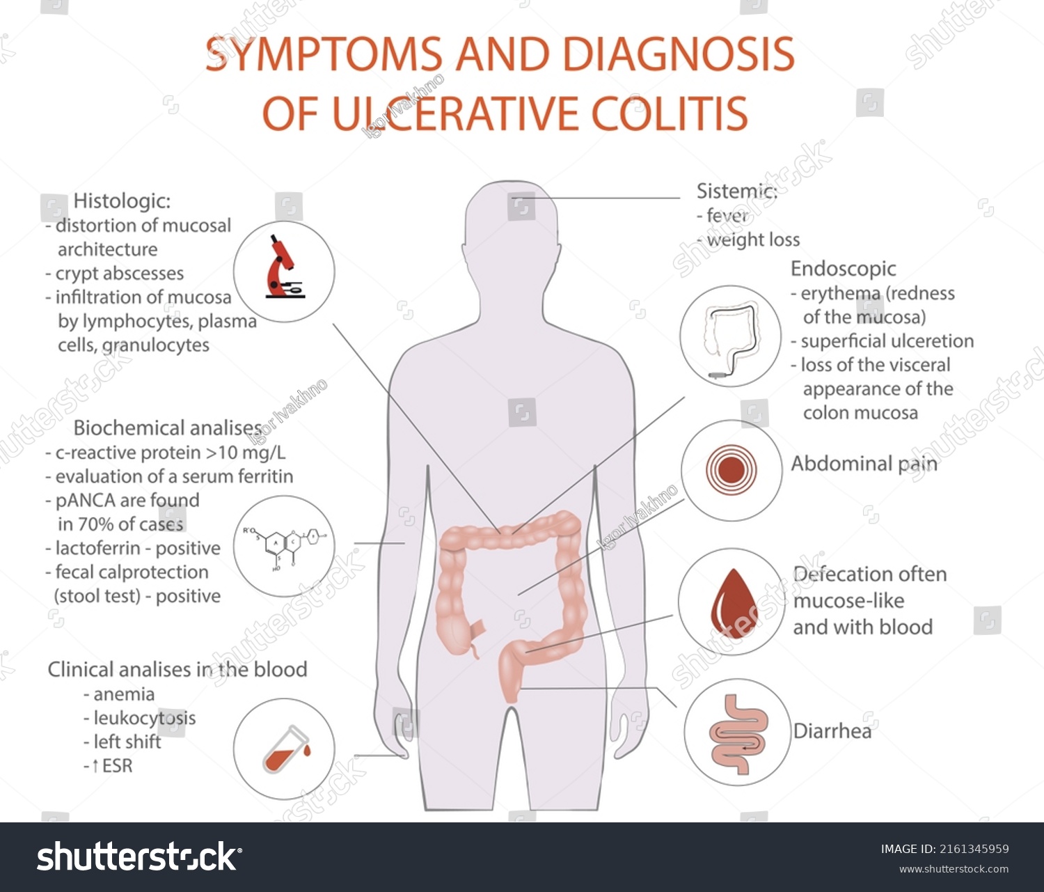 Symptom Ulcerative Colitis Vector Medical Diagram Stock Vector Royalty Hot Sex Picture 