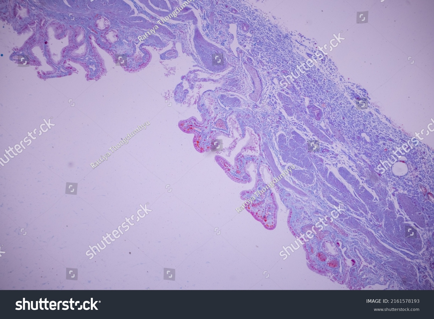 Columnar Epithelium Human Gall Bladder Under Stock Photo 2161578193 