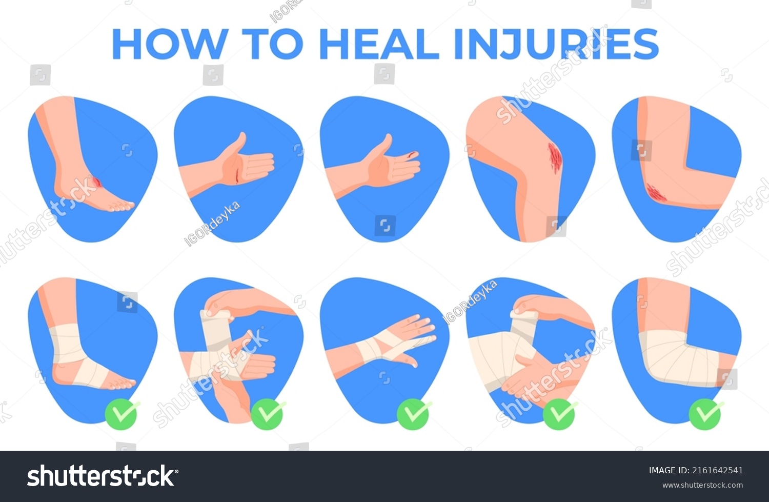 First Aid Hand Injuries Bandage Human Stock Vector (Royalty Free ...