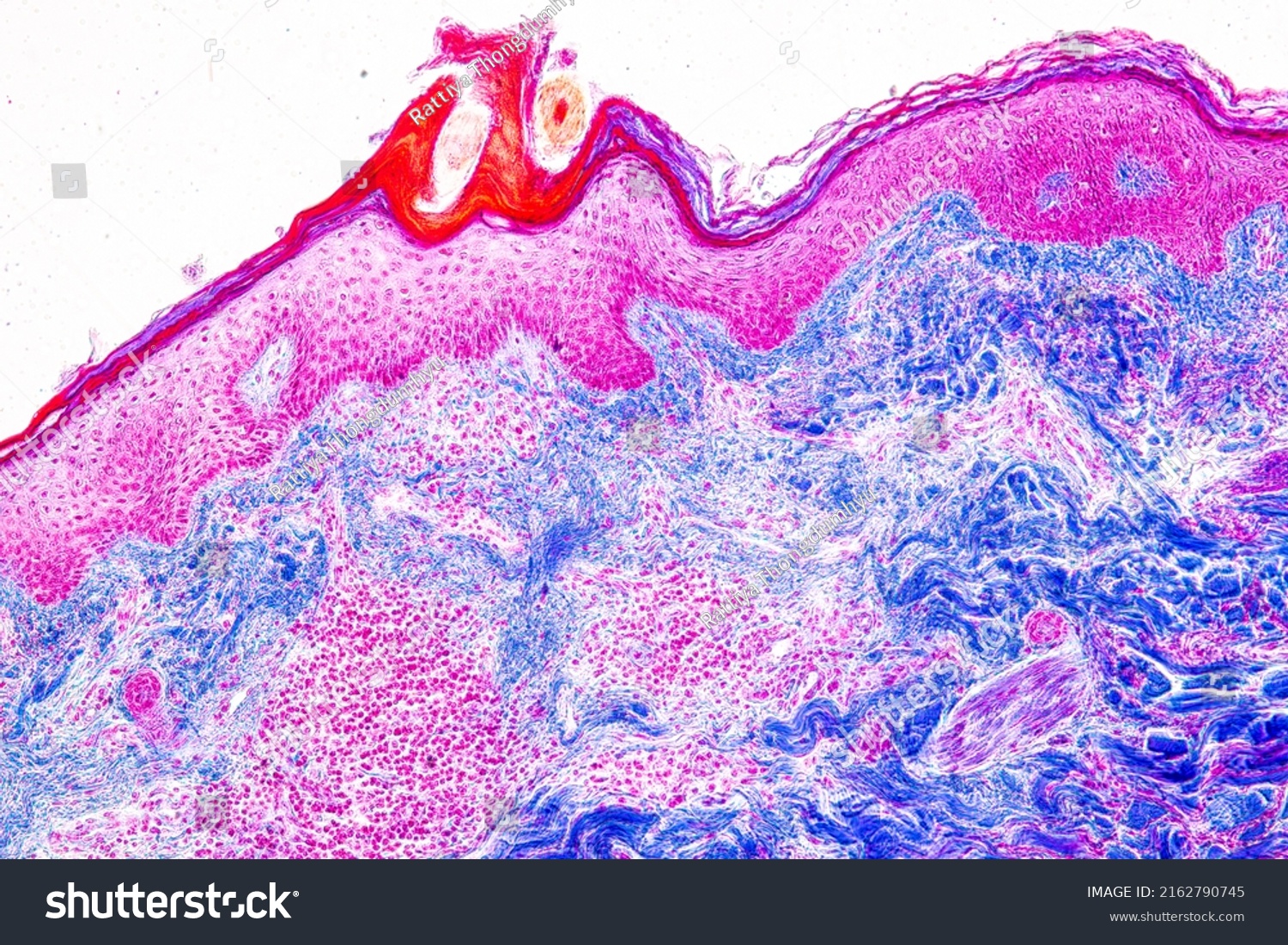 Scalp Hair Follicles Human Under Microscope Stock Photo 2162790745 ...