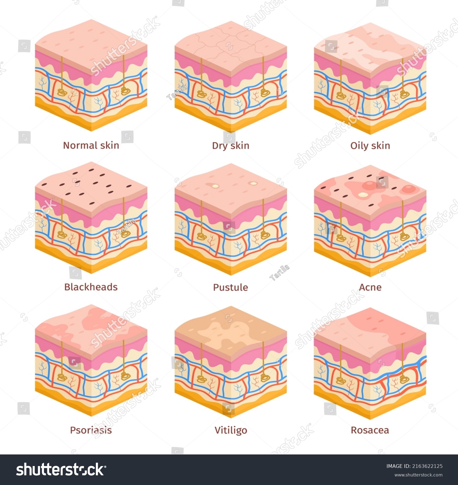 3d Human Skin Types Cross Section Stock Illustration 2163622125 ...