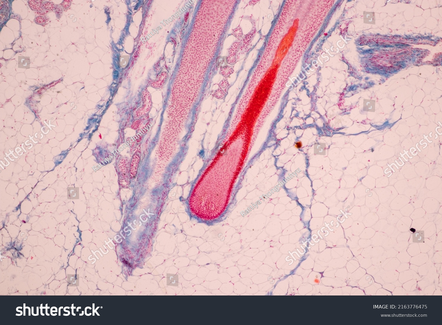 Scalp Hair Follicles Human Under Microscope Stock Photo 2163776475 ...