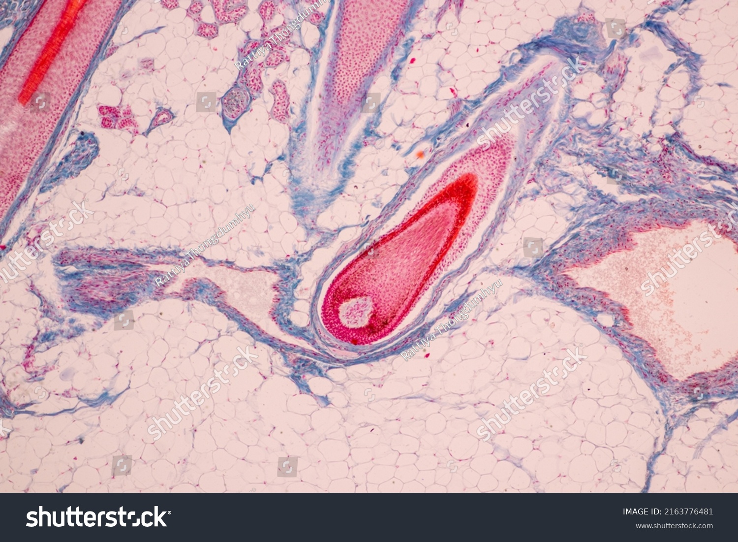 Scalp Hair Follicles Human Under Microscope Stock Photo 2163776481 ...