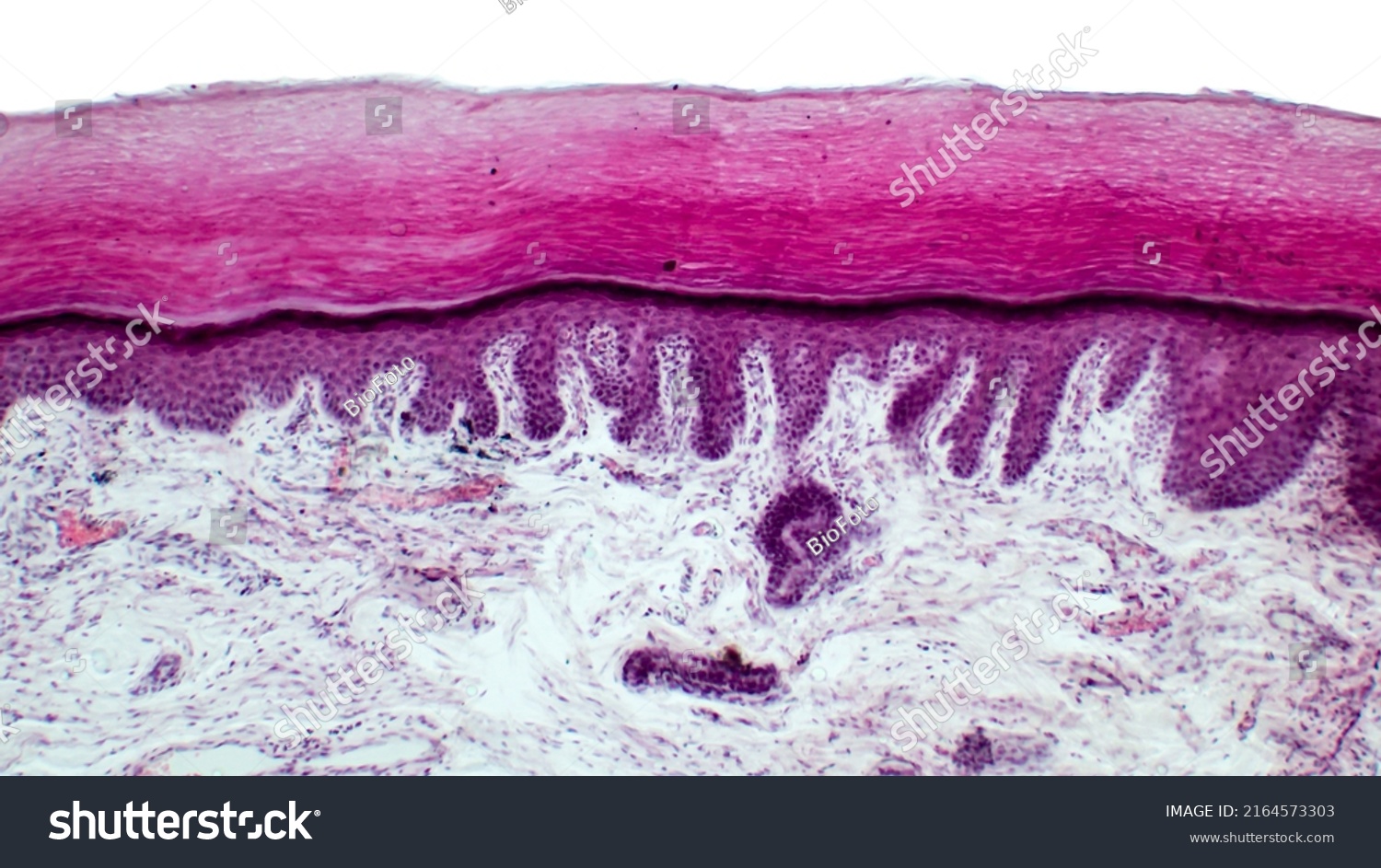 Punch Biopsy Skin Layers Human Skin Stock Photo 2164573303 | Shutterstock