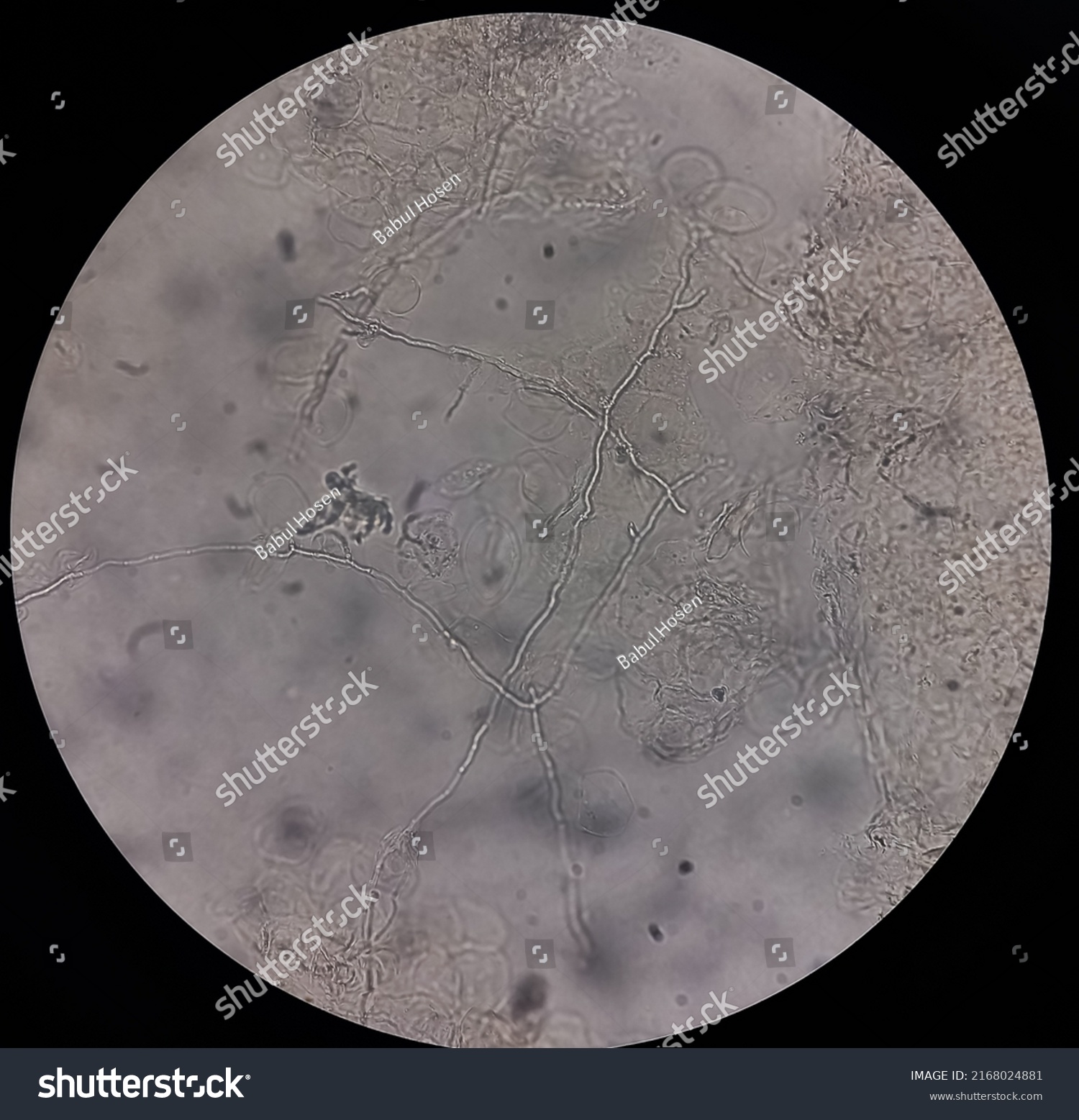 Microscopic View Hyphae Dermatophytes Fungus Test Stock Photo ...