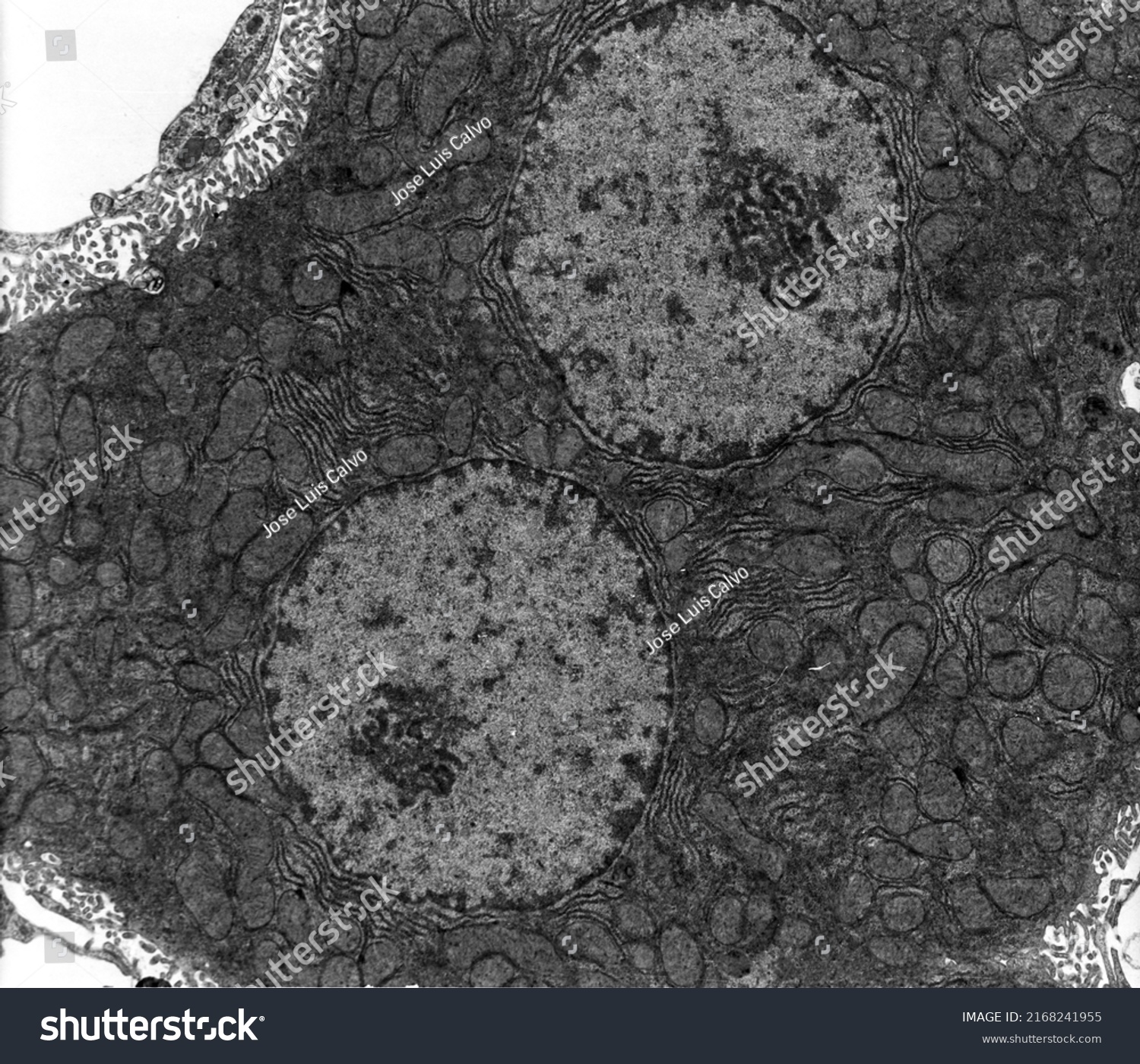 Tem Micrograph Showing Binucleated Hepatocyte Many Stock Photo ...