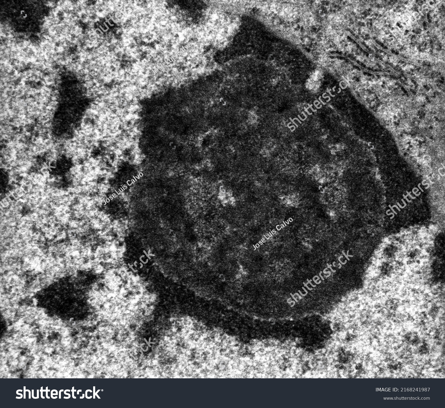 High Magnification Tem Micrograph Showing Nucleolus Stock Photo ...