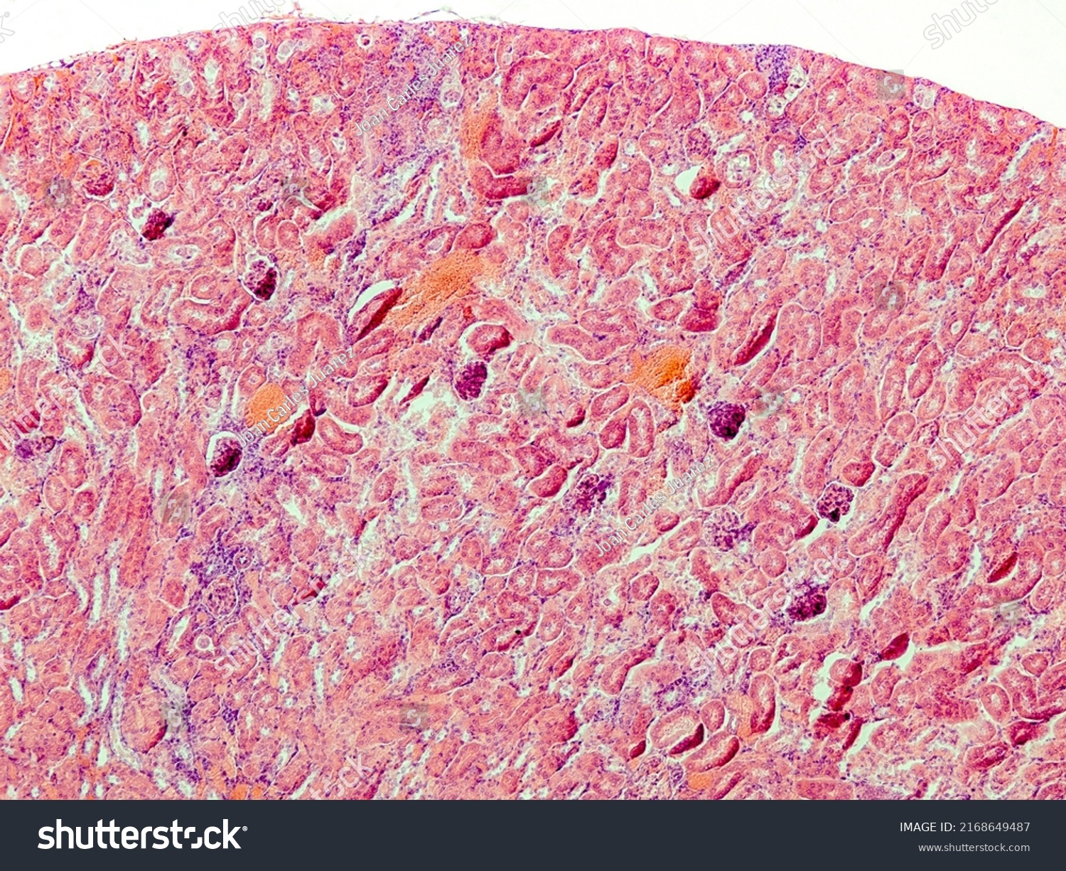 Mouse Kidney Cross Section Under Microscope Stock Photo 2168649487 ...