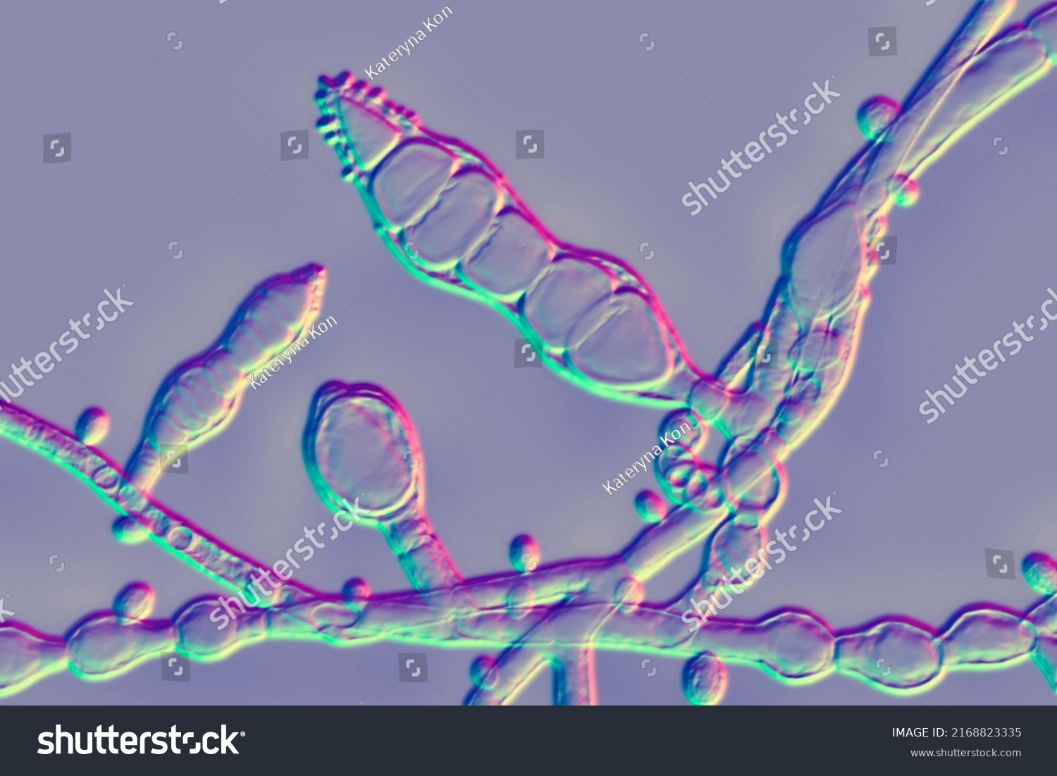 Microscopic Fungi Microsporum Audouinii 3d Illustration Stock ...