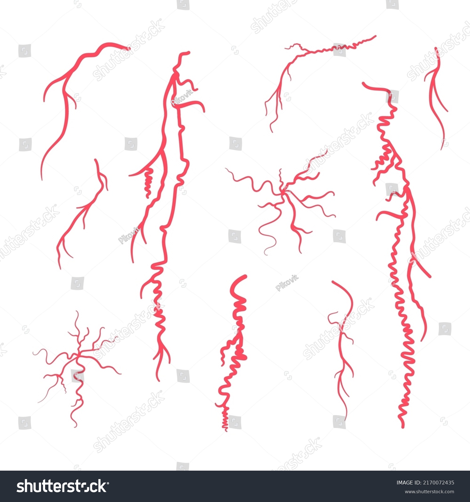 Red Veins Anatomy Varicose Disease Spider Stock Vector (Royalty Free ...