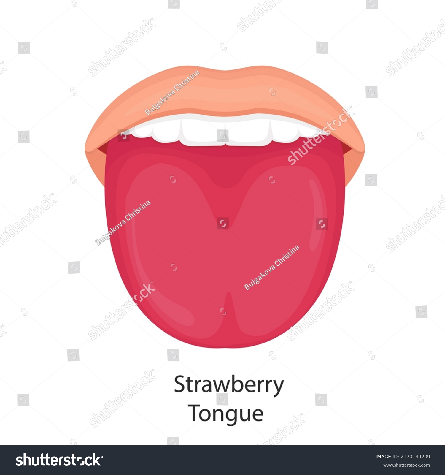 Vector Illustration Strawberry Tongue Stock Vector (Royalty Free ...