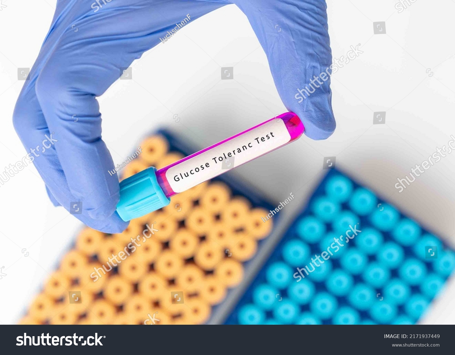 biochemistry-blood-sample-glucose-tolerance-test-stock-photo-2171937449