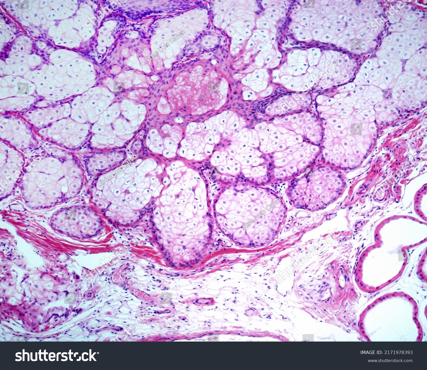 Sebaceous Glands Holocrine Glands Whose Cells Stock Photo 2171978393 ...