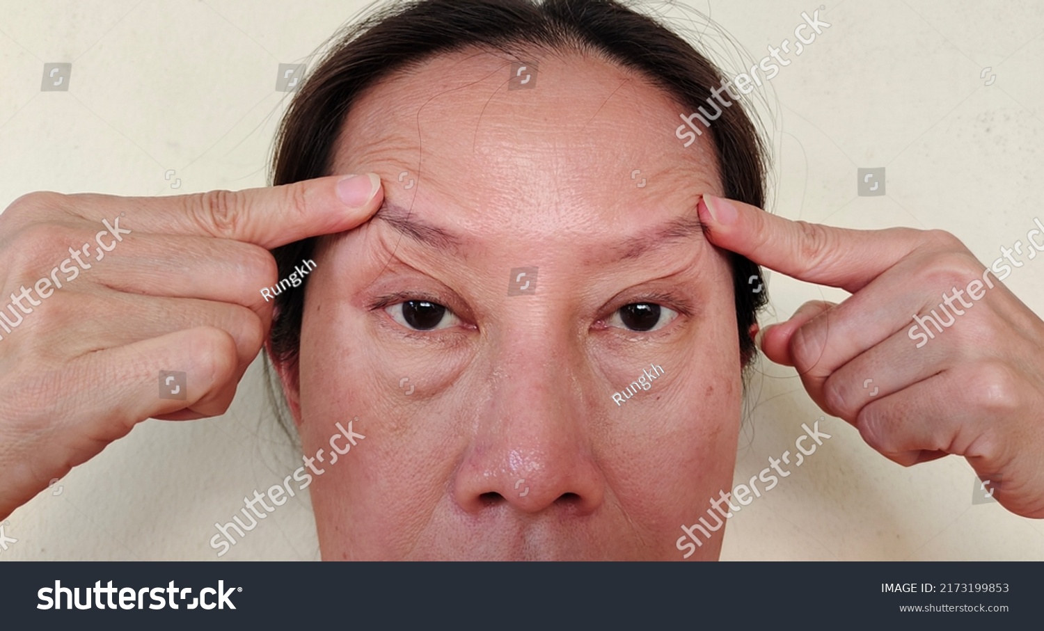 Portrait Showing Fingers Touching Flabbiness Skin Stock Photo