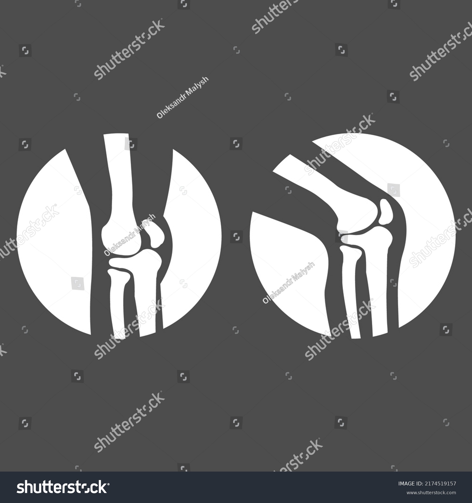 Human Knee Joint Side View Vector Stock Vector (royalty Free 