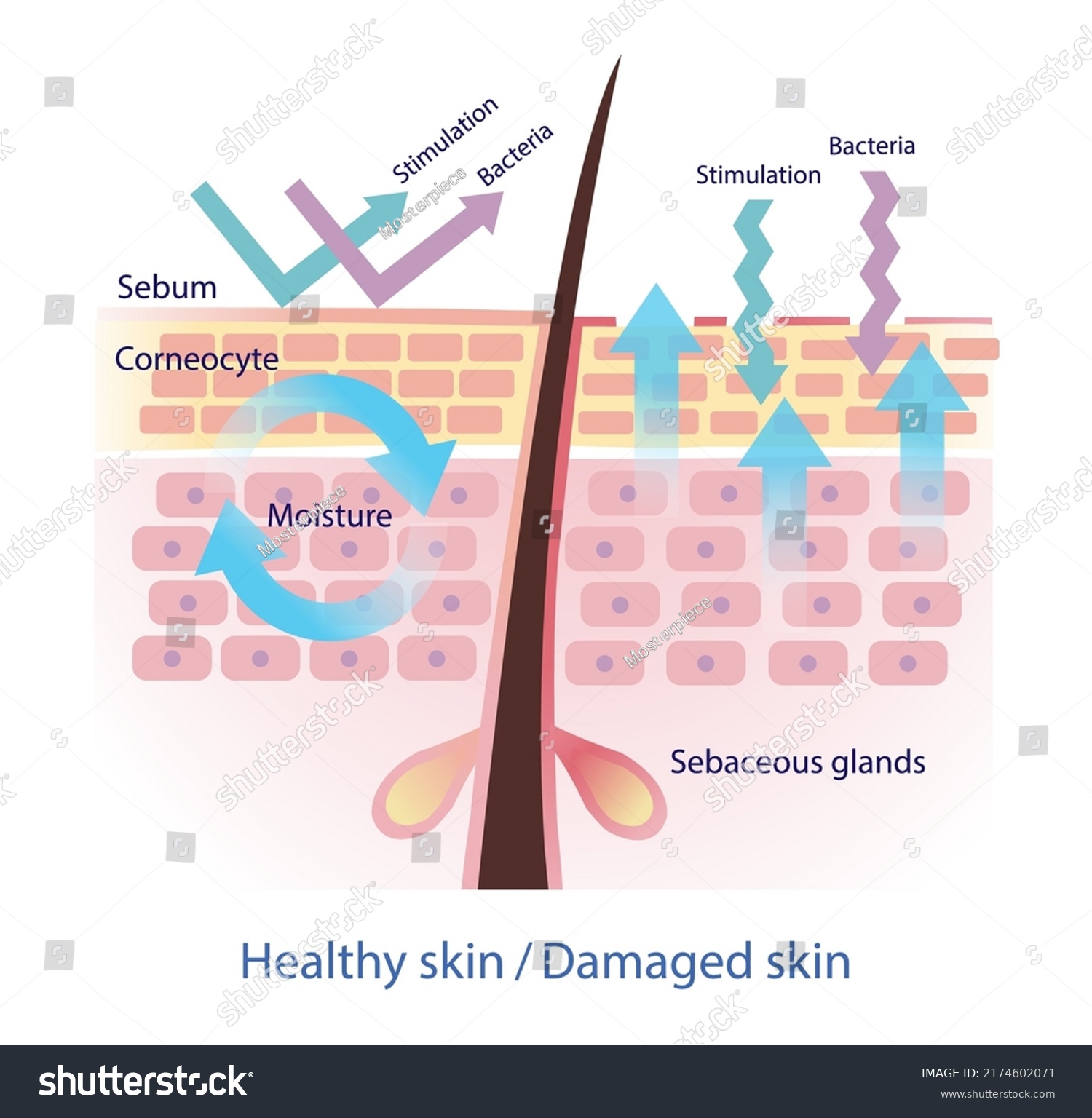 Comparison Healthy Damaged Skin Barrier Vector Stock Vector (Royalty ...