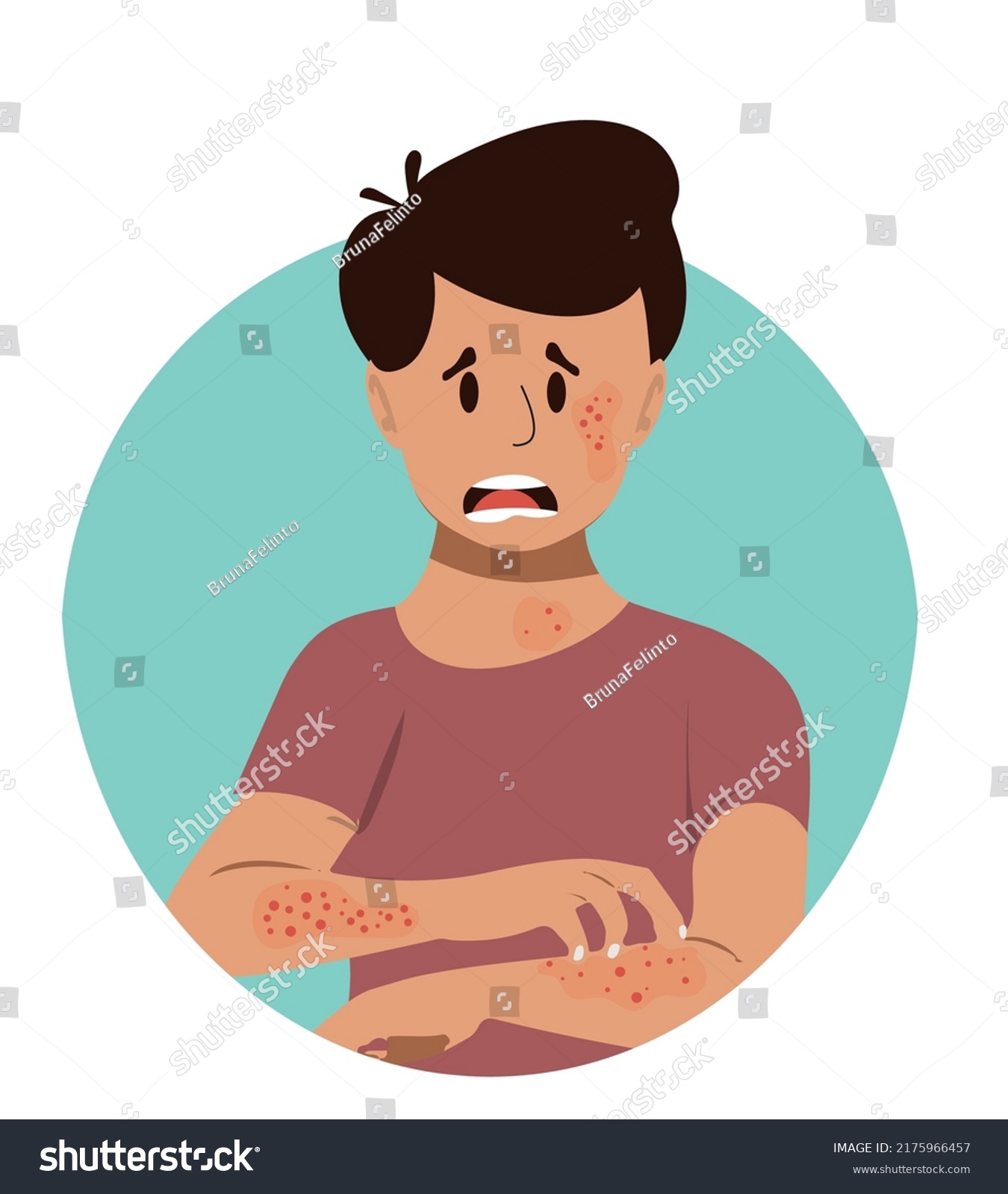 Cartoon Boy Scratching His Arms Decorated Stock Vector (Royalty Free ...