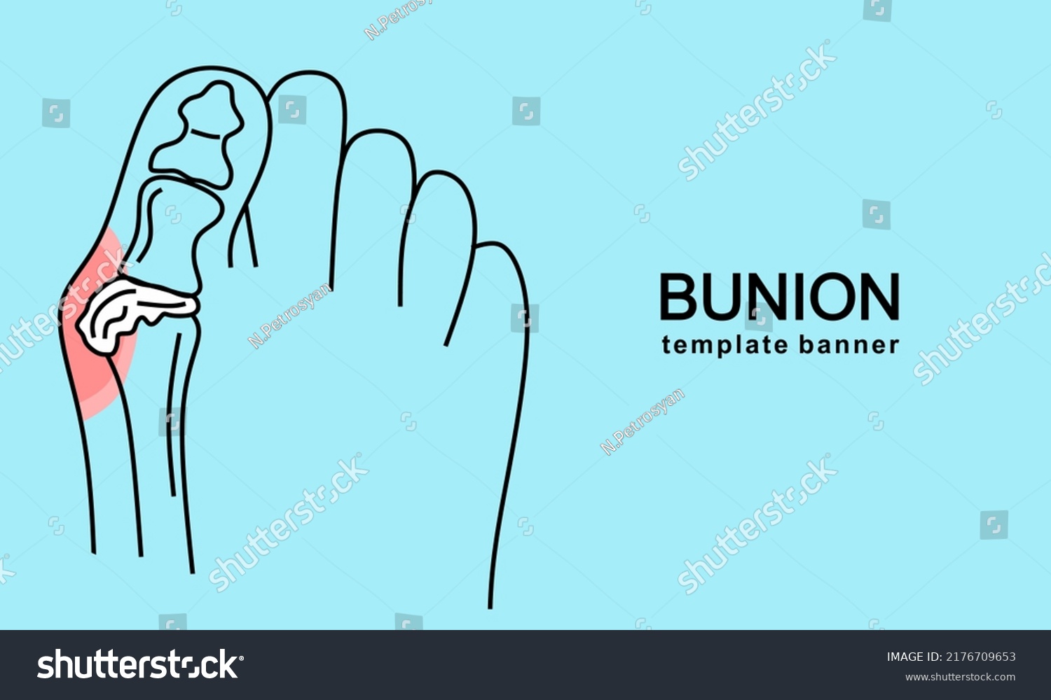 Bunion Foot Template Banner Abstract Minimal Stock Vector (Royalty Free ...