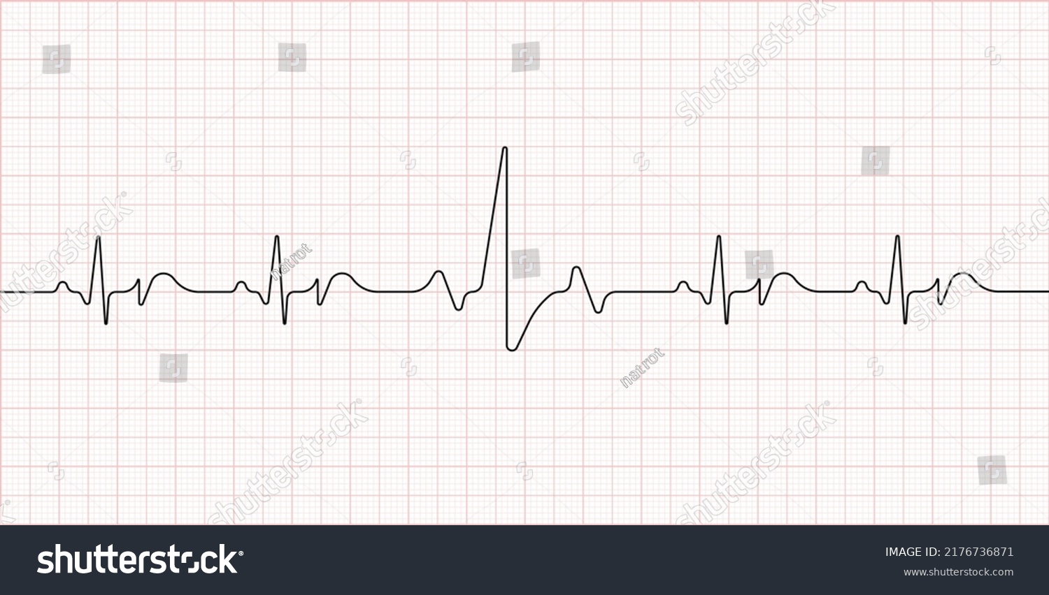 Electrocardiogram Heart Beat Medical Healthcare Symbol Stock Vector ...