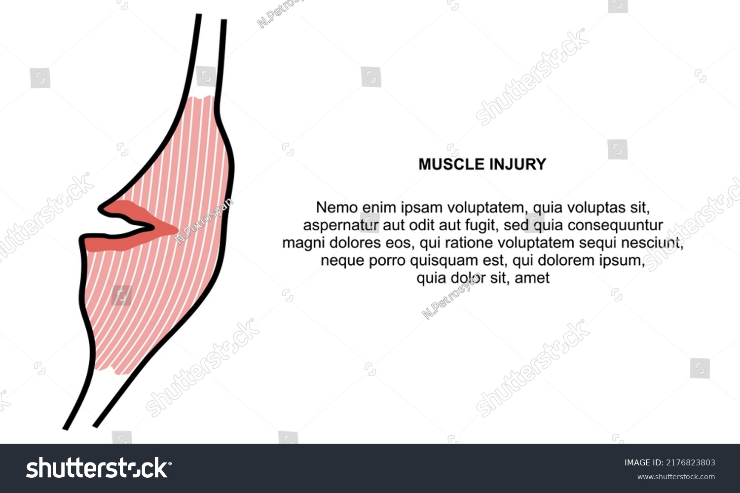 muscle-injury-banner-muscle-pain-template-stock-vector-royalty-free