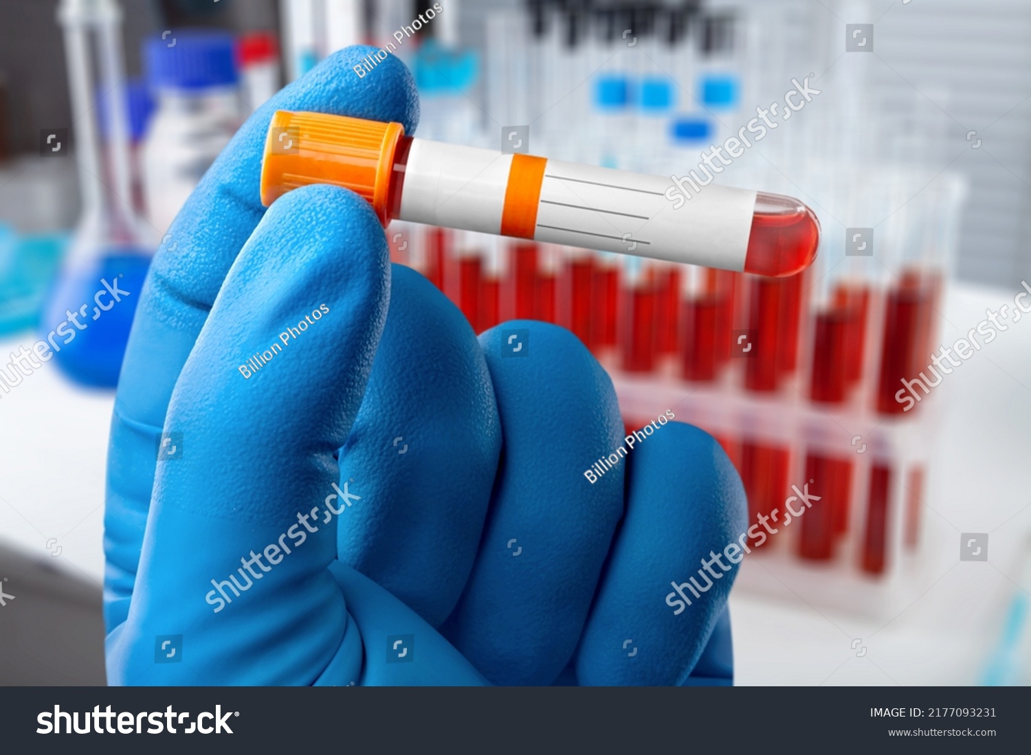 Blood Sample Patient Complete Screening Test Stock Photo 2177093231 ...