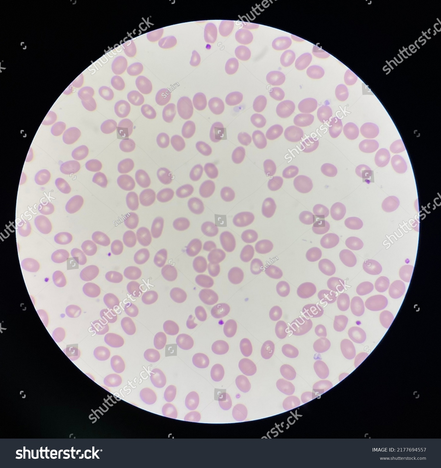 Red Blood Cells Macro Ovalocyte Stock Photo 2177694557 | Shutterstock