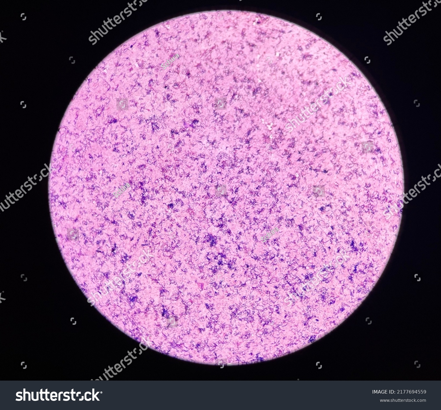 Bacteria Cell Gram Stain Gram Positive Stock Photo 2177694559 ...