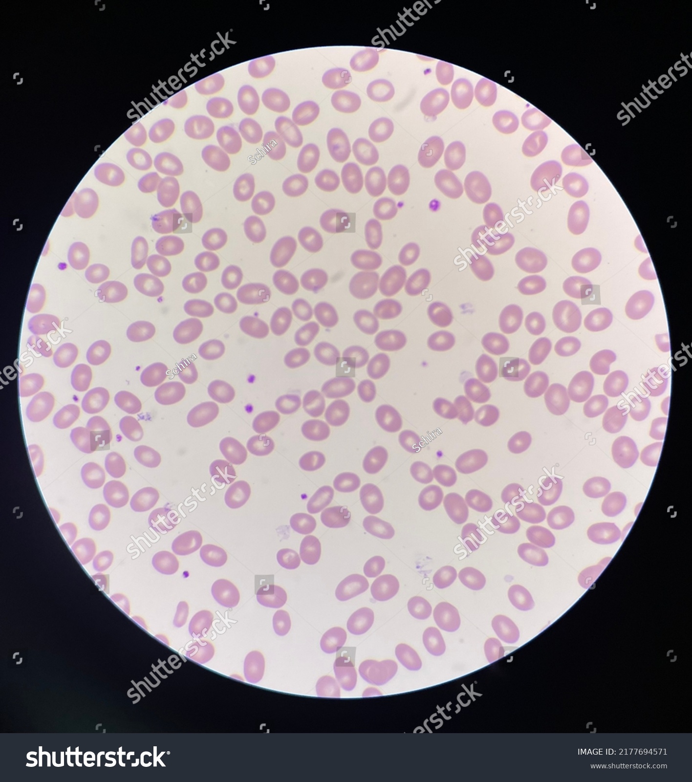 Red Blood Cells Macro Ovalocyte Stock Photo 2177694571 | Shutterstock