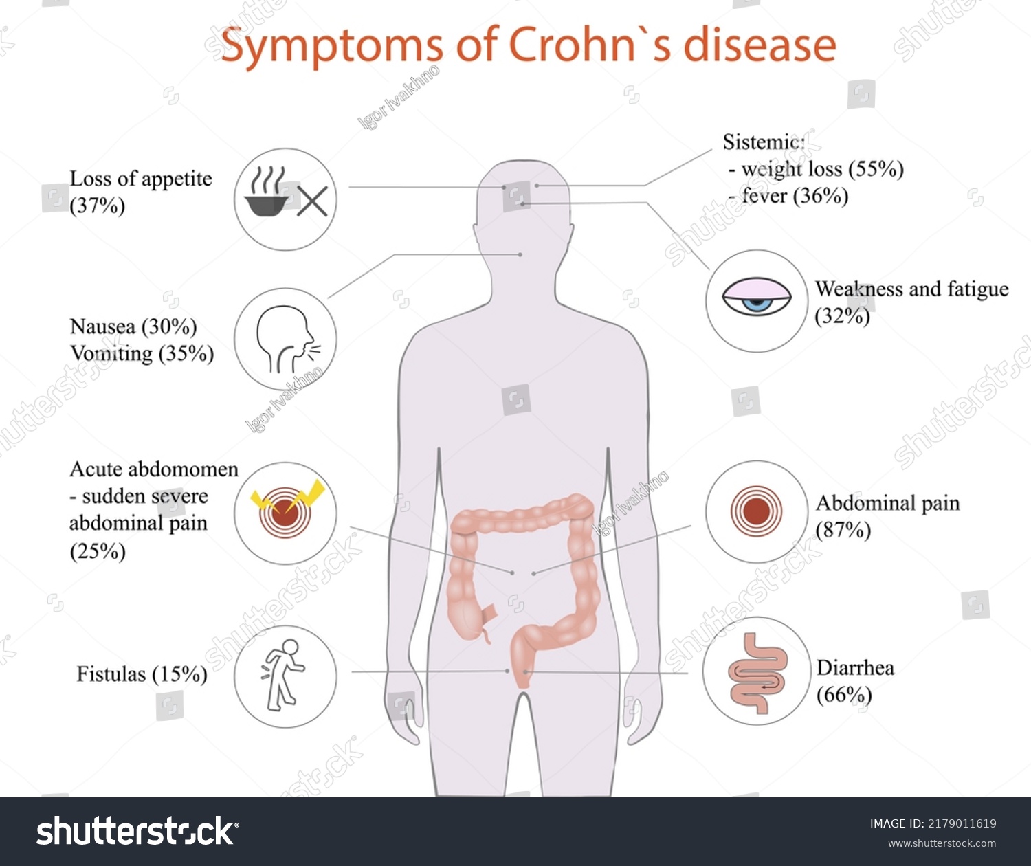 Vector Illustration Crohns Disease Symptoms Stock Vector (Royalty Free ...