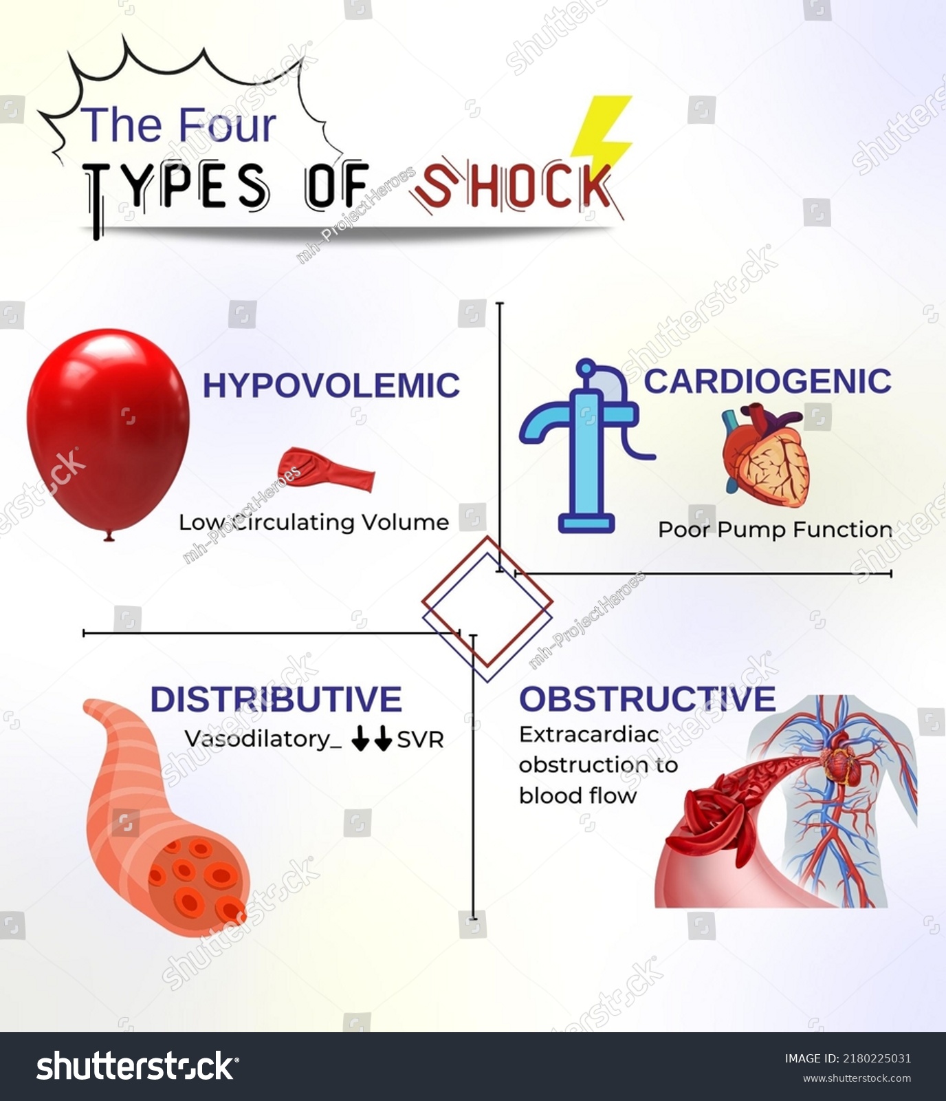 Four Types Shock Poster Doctors Nurses Stock Illustration 2180225031 ...