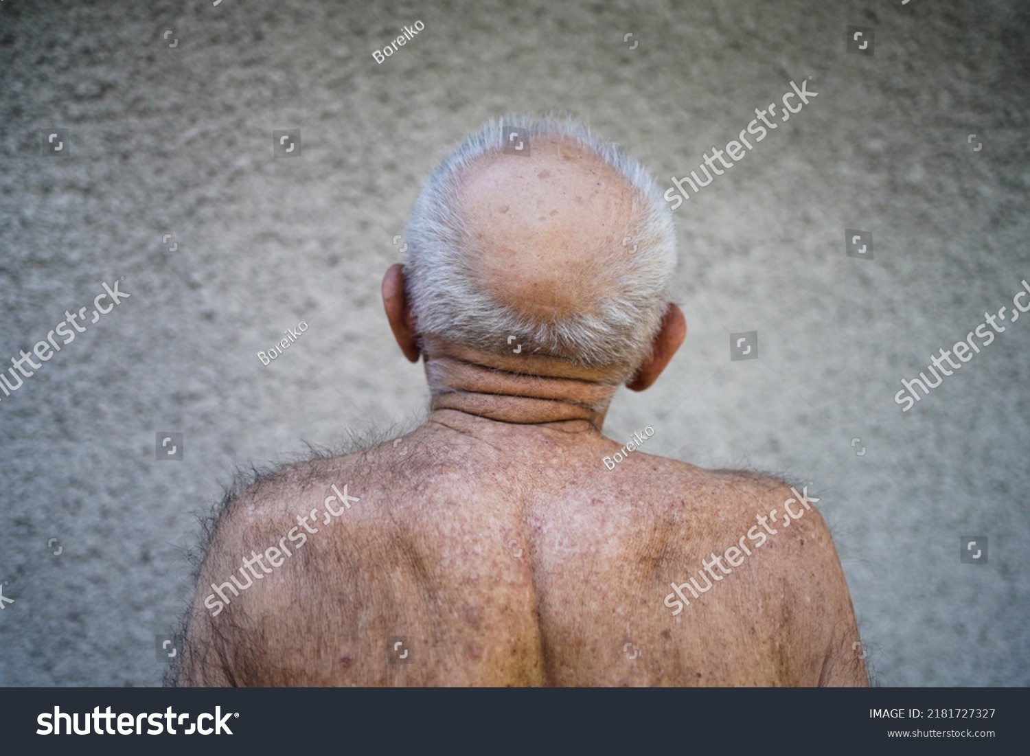 Hair Loss Men Bald Head Old Stock Photo 2181727327 Shutterstock
