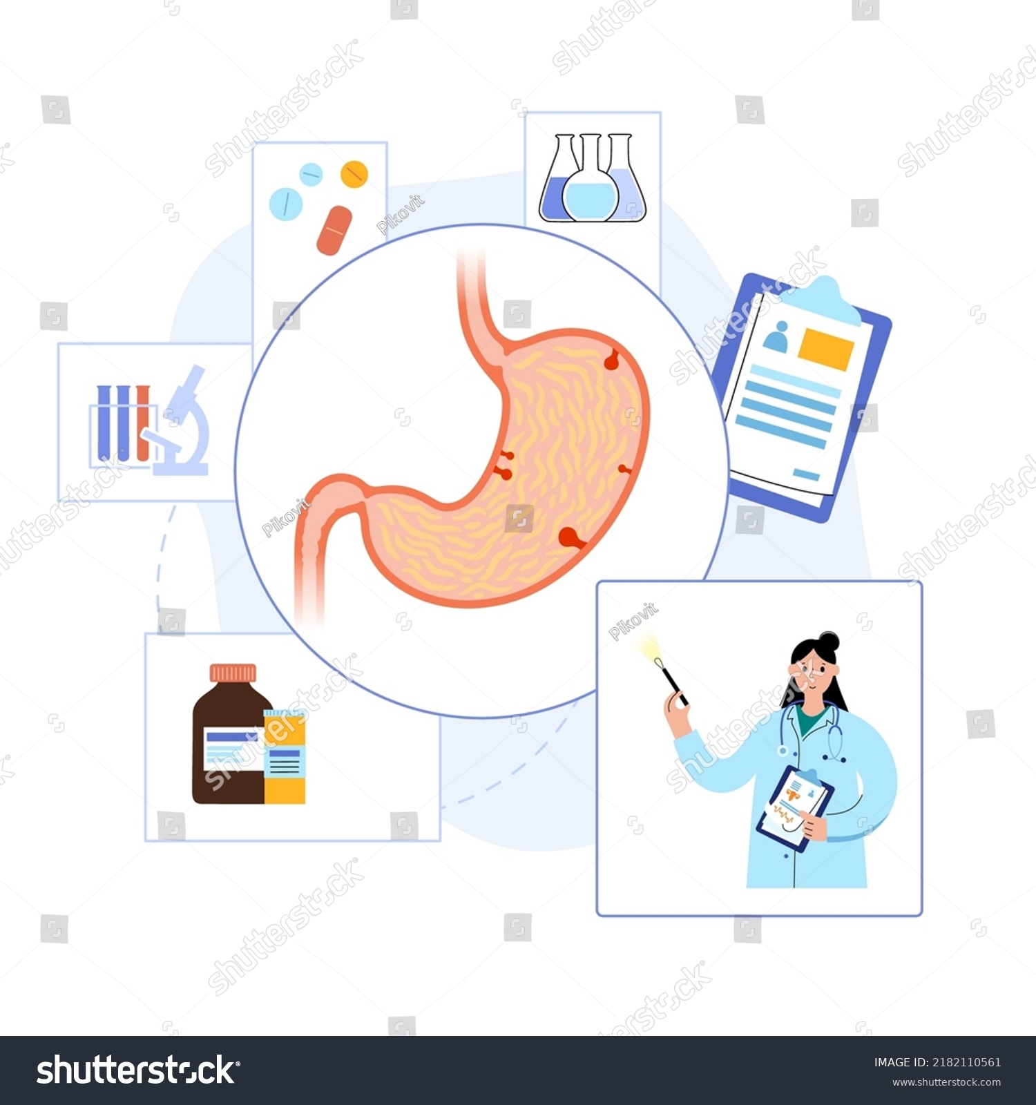 Stomach Polyps Diagnostic Removal Consultation Doctor Stock Vector Royalty Free 2182110561