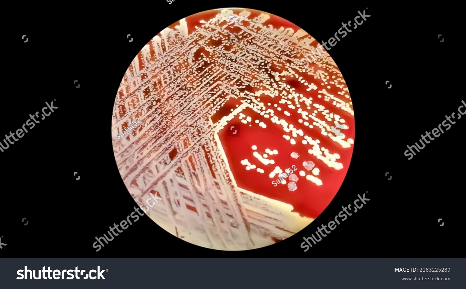 Staphylococcus Aureus: Gram-positiv, Zu Gram-variabel, Nichtmotilisch ...