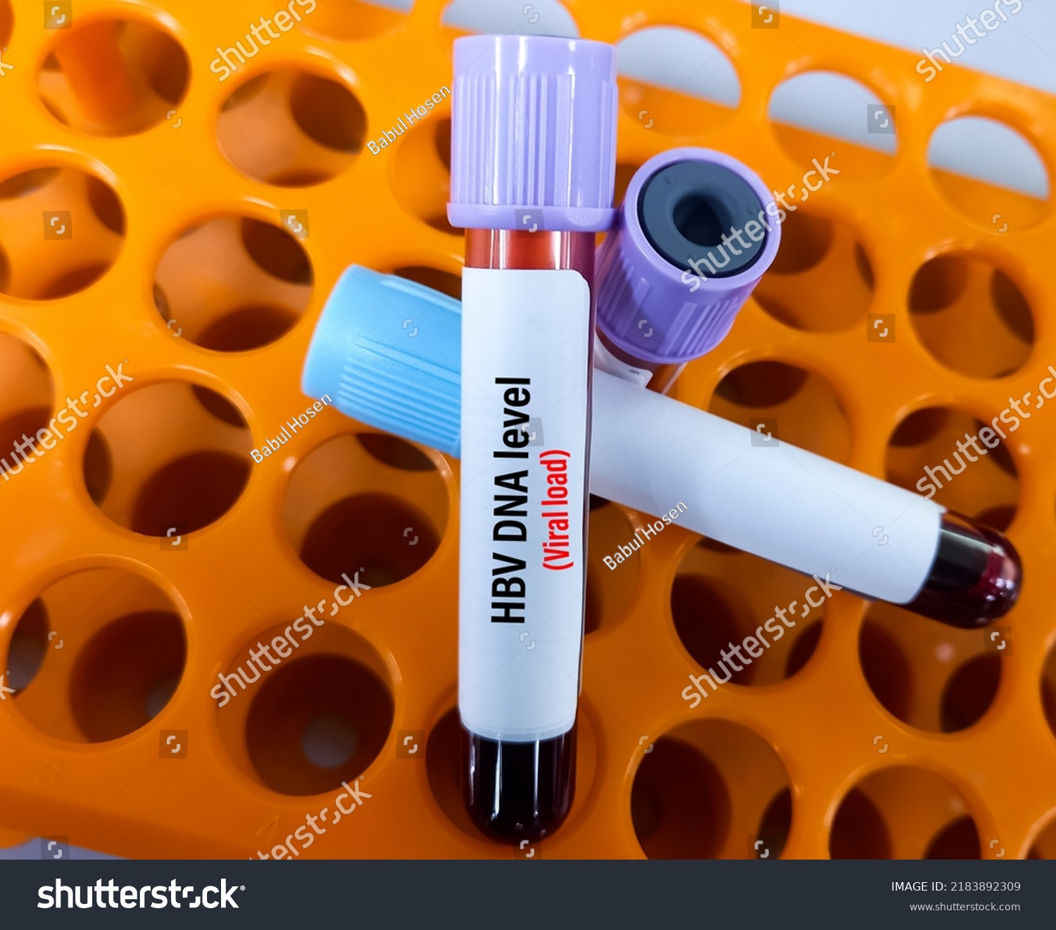 blood-sample-pcr-hbv-dna-viral-stock-photo-2183892309-shutterstock