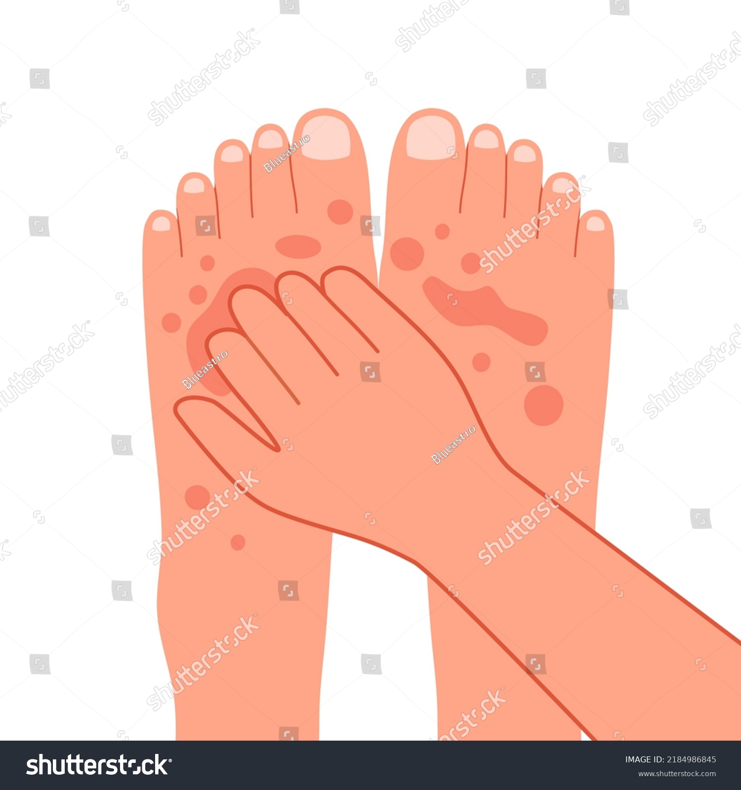 Foot Bite Images Stock Photos Vectors Shutterstock