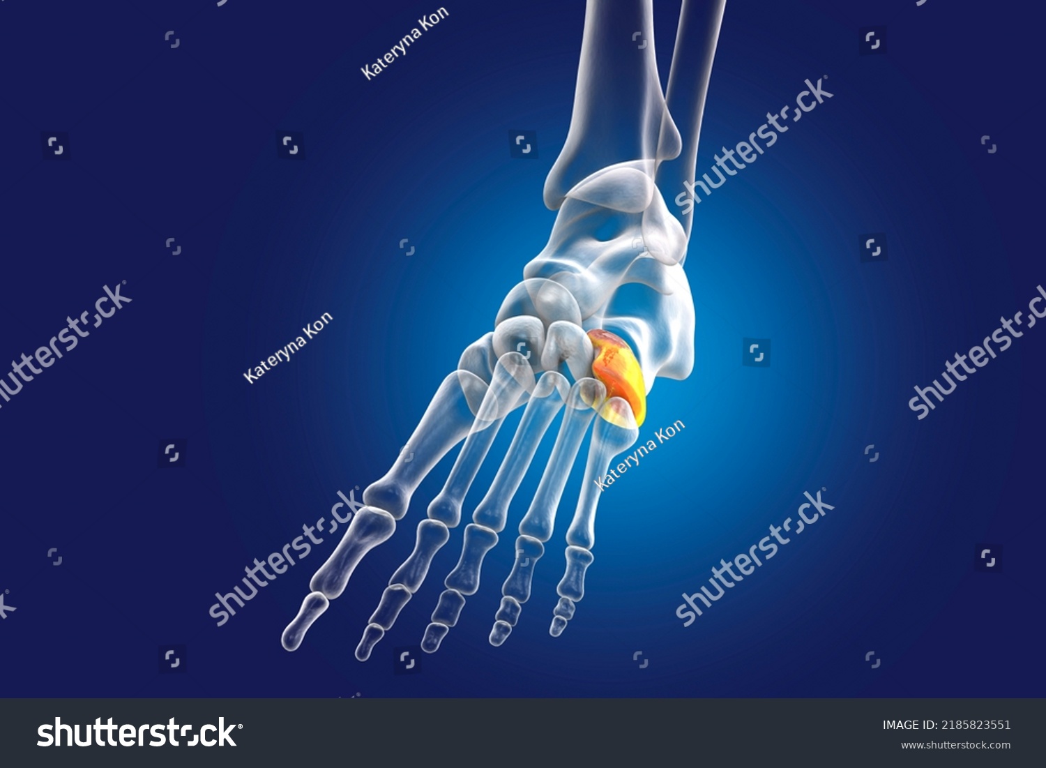 Cuboid Bone Foot One Tarsal Foot Stock Illustration 2185823551 ...