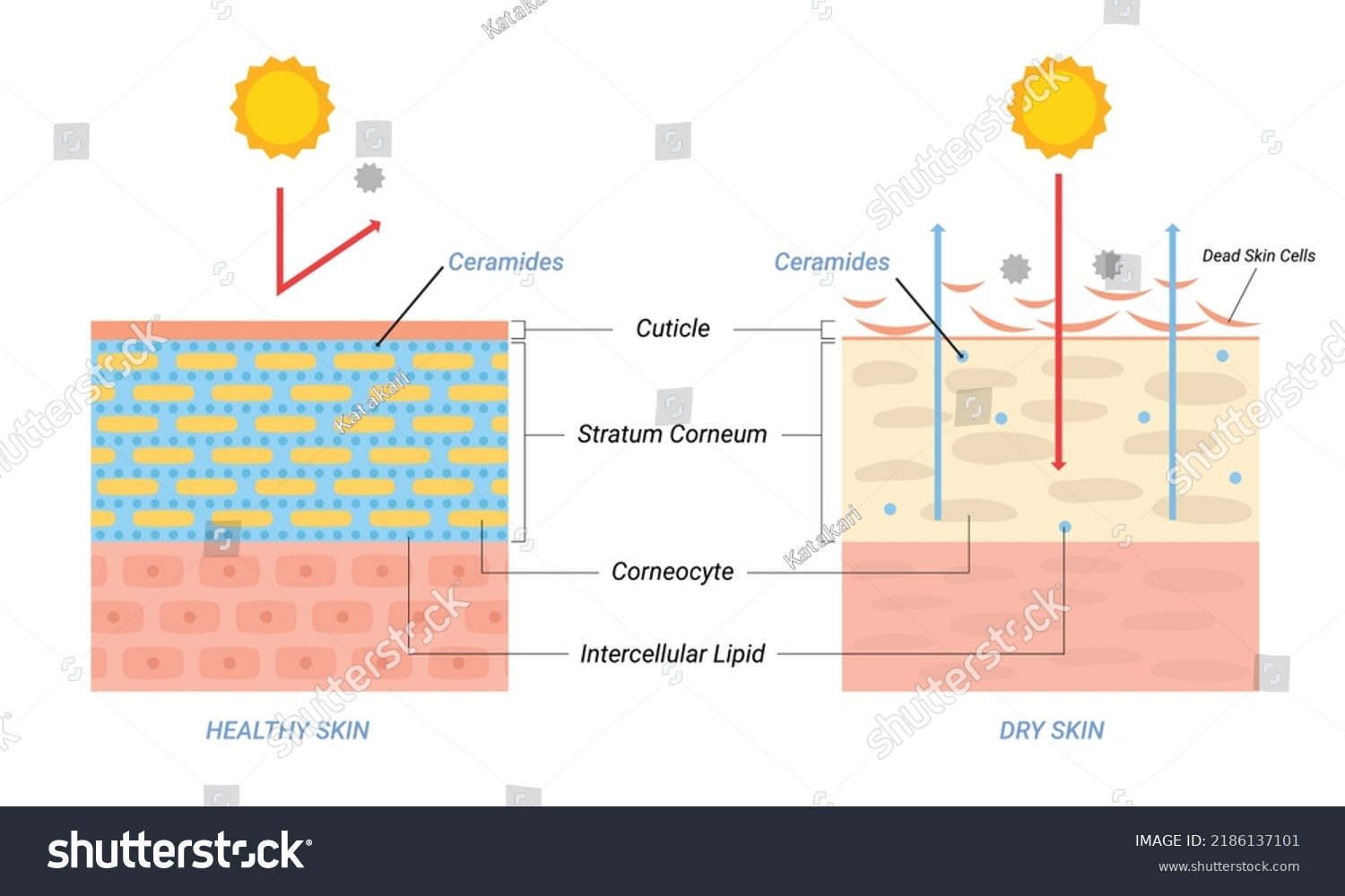 Dry Healthy Skin Layer Illustration Beauty Stock Vector (Royalty Free ...