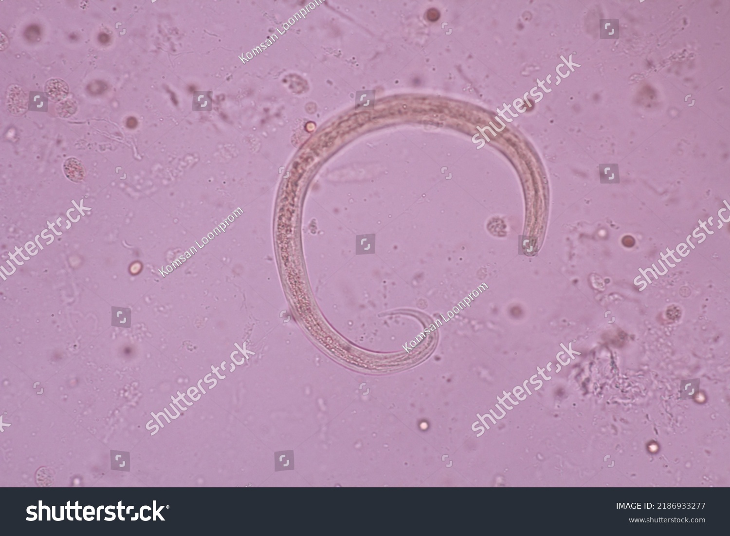 view-microscopic-strongyloides-stercoralis-threadworm-human-stock-photo