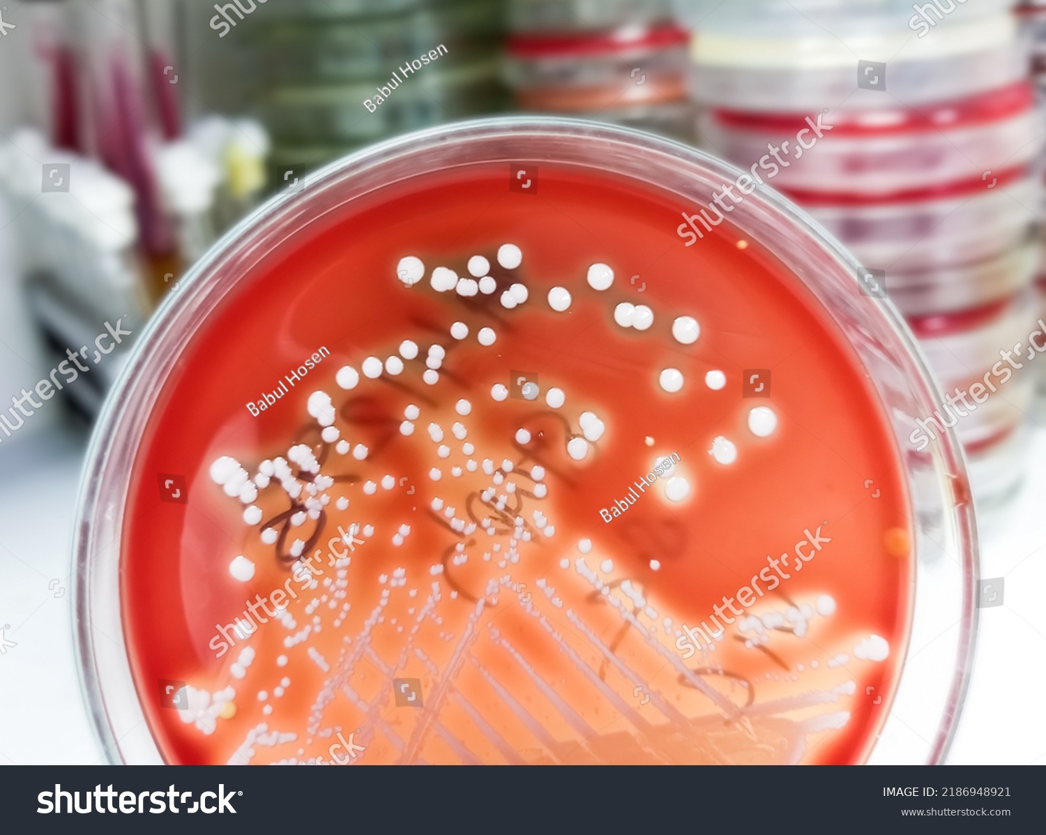 Staphylococcus Aureus Grampositive Gramvariable Nonmotile Coccus Stock ...