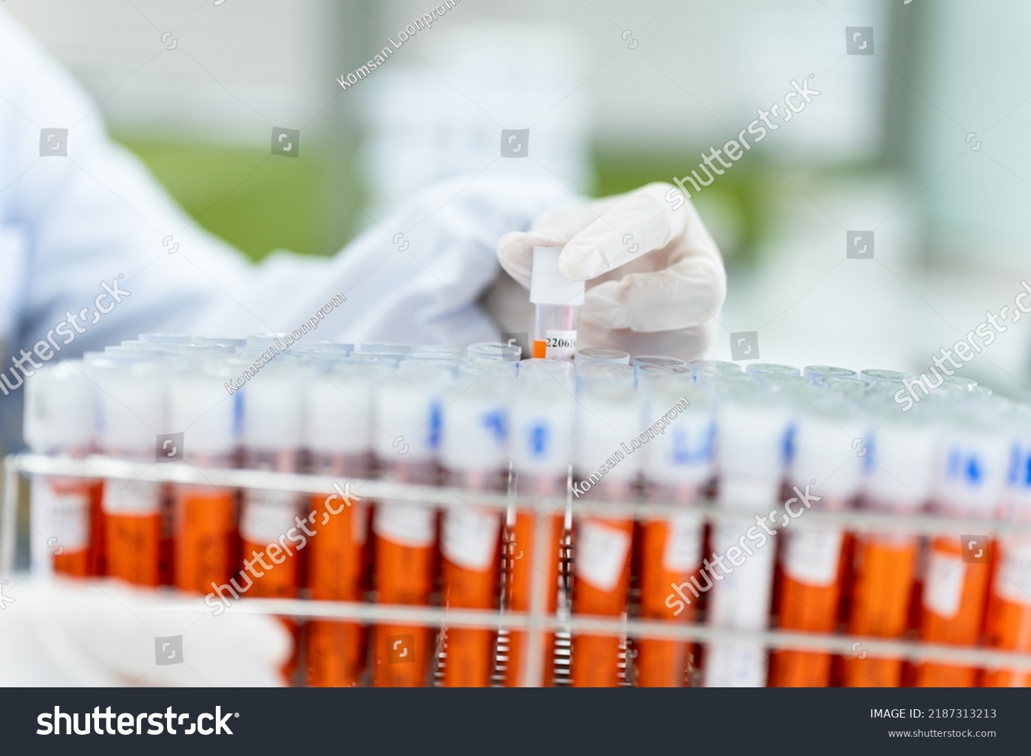 Scientist Hand Tube Blood Sample Rack Stock Photo 2187313213 | Shutterstock