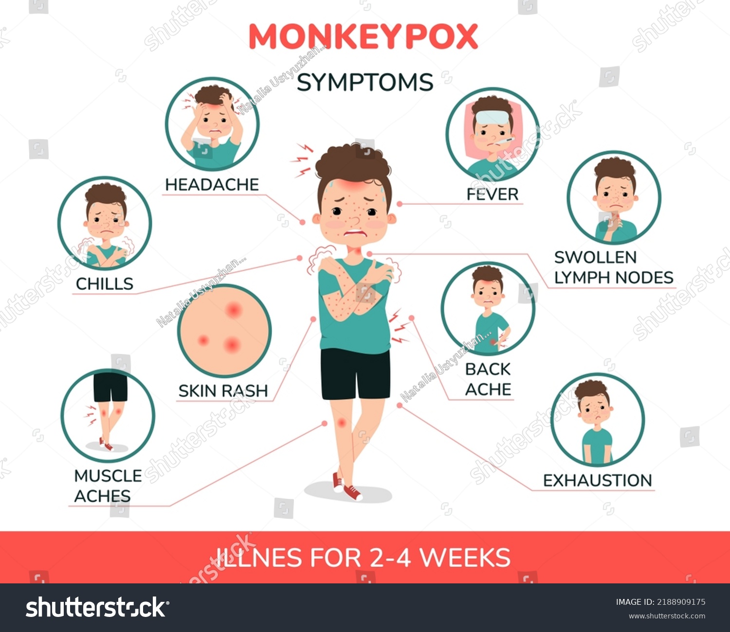 Boy Monkeypox Symptoms Illustration Fever Headache Stock Vector ...