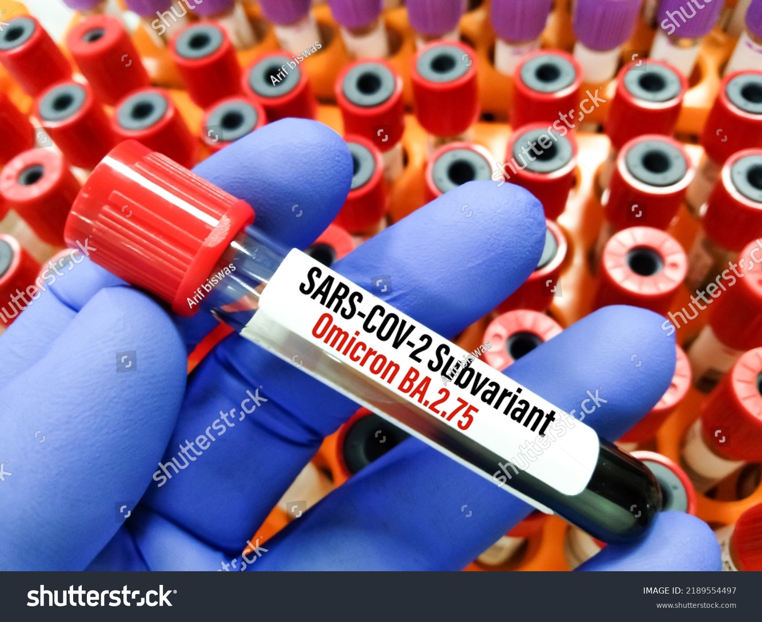 Blood Sample New Omicron Subvariant Ba275 Stock Photo 2189554497