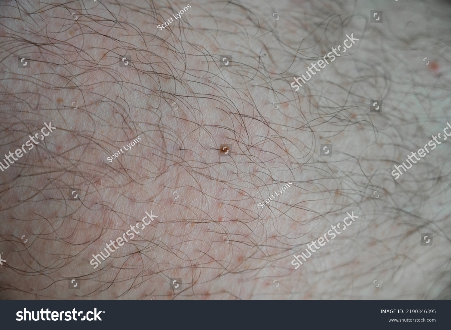  Single Freckle Isolated On Leg Covered Stock Photo 2190346395 ...