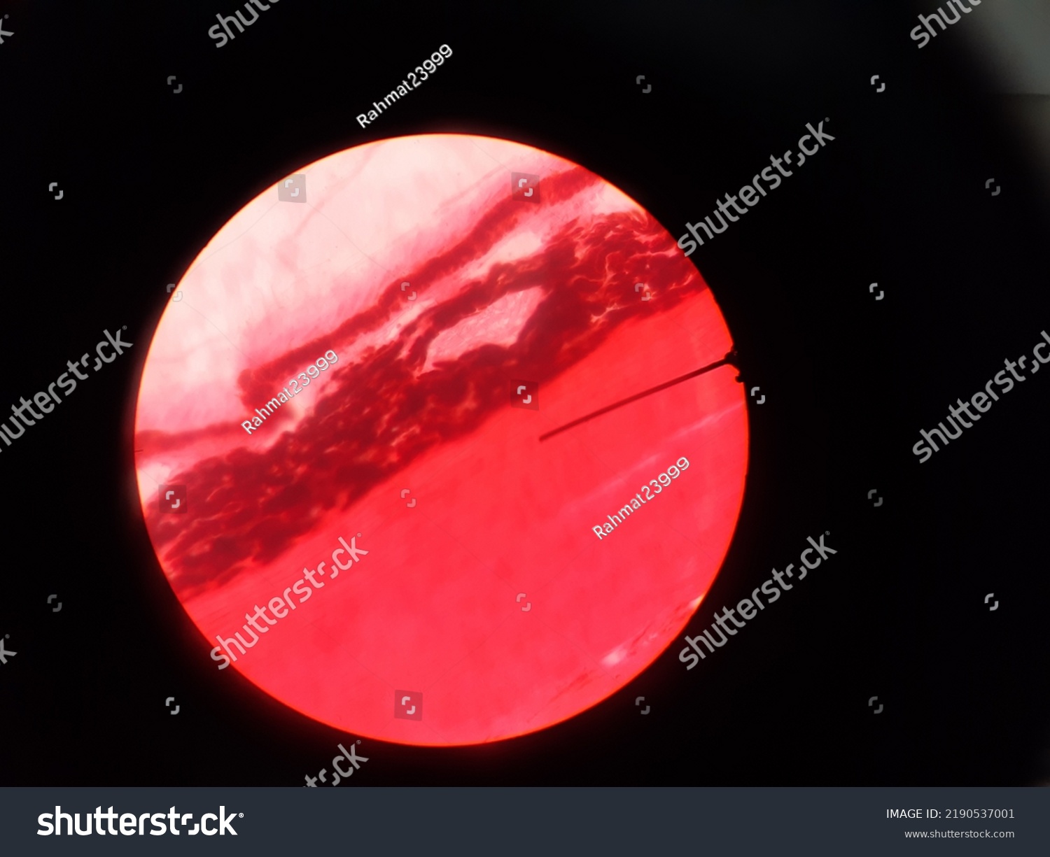 Histology Eye Ear Skin Using Microscope Stock Photo 2190537001 ...